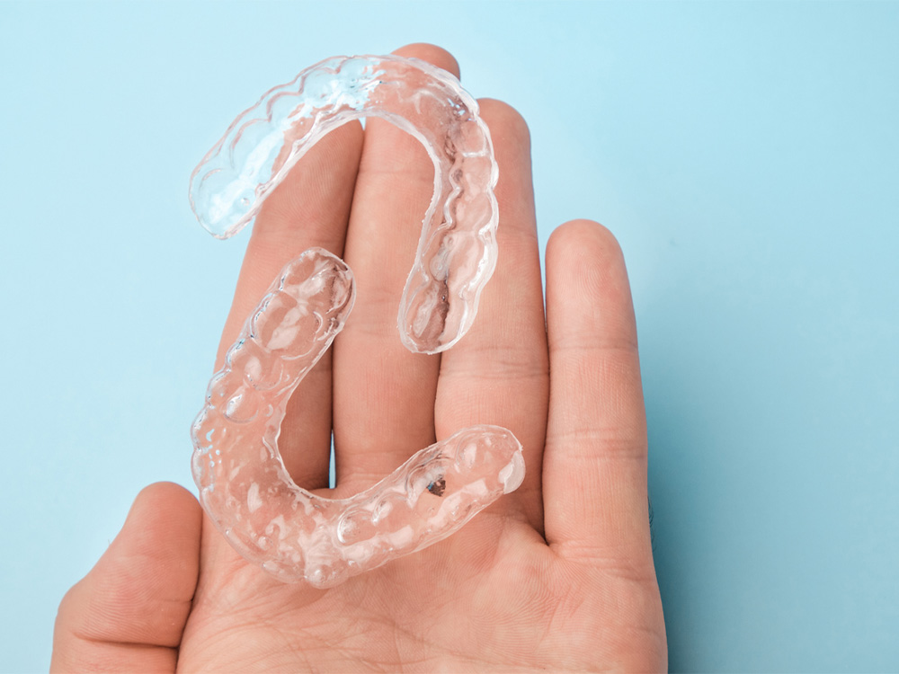 person holding a set of clear aligners in hand