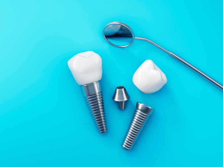 dental implants laying on blue background