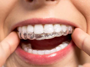 About Invisalign and restorative dental care options in Palos Heights, IL, at Palos Heights Family Dental