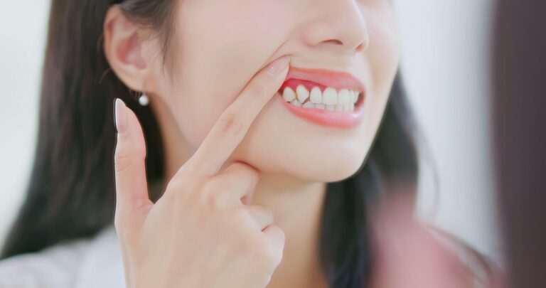 woman inflamed swollen gums